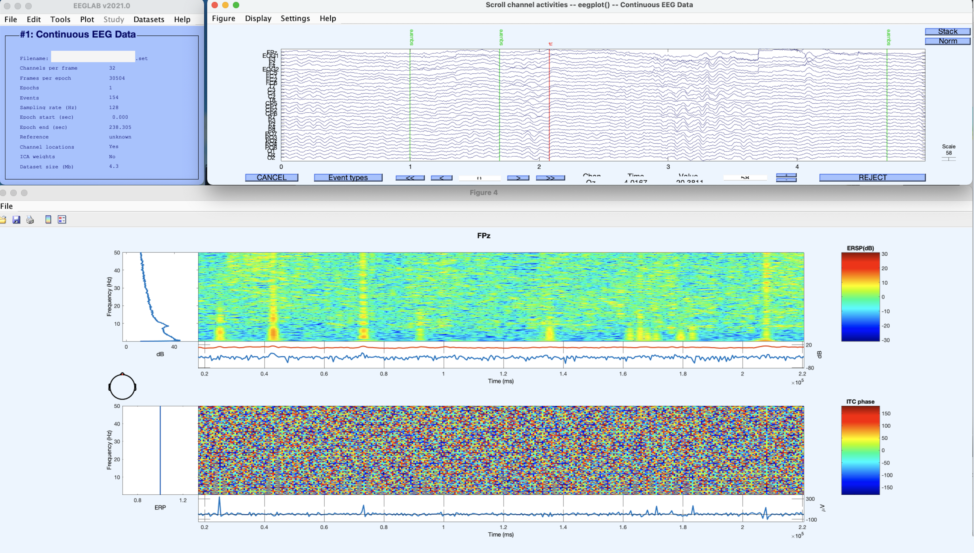 Biofeedback Center® mapeo cerebral: pipeline de análisis de un registro EEG de 32 canales. Copyright© Bfc®