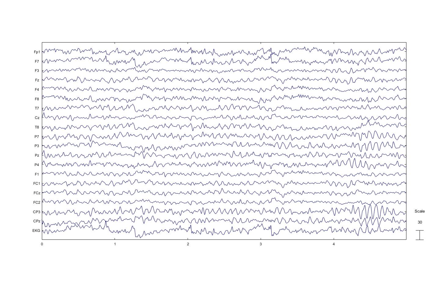 Biofeedback Center® mapeo cerebral:Registro de EEG después de la limpieza de los canales y electrodos 