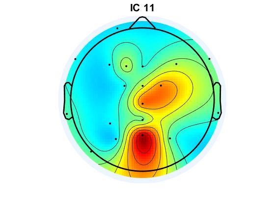 Mapeo cerebral en Biofeedback Center® Espectrotopo que muestra la localización de un componente. Investigaión atención en videojuegos. Copyright© Bfc®