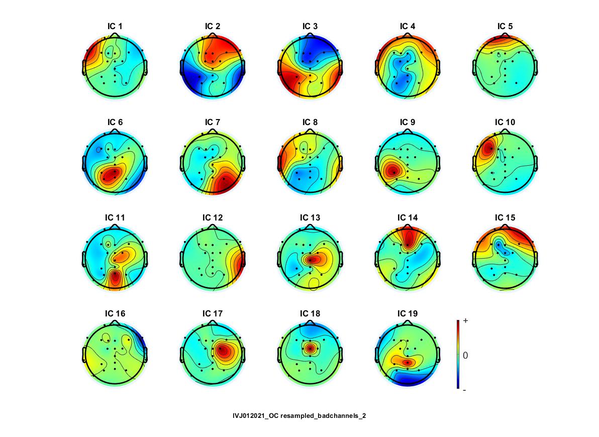 EEGLAB en Biofeedback Center®: identificación de componentes independientes. Investigación de atención en videojuegos. Copyright© Bfc®